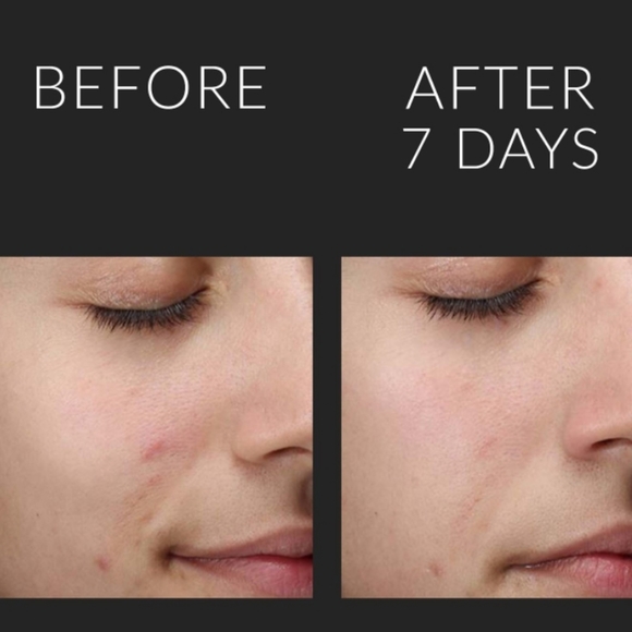 Kate Somerville Loquid Exfolikate LARGE BOTTLE - Picture 6 of 16